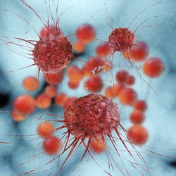 Иммунотерапия – новая надежда больных меланомой? 