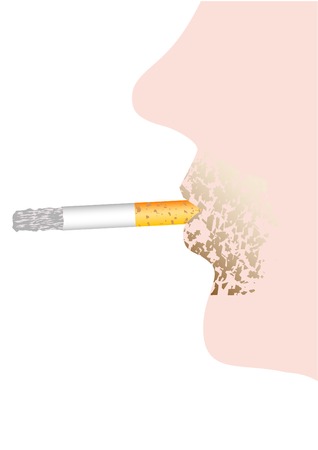 рак губы влияние курения